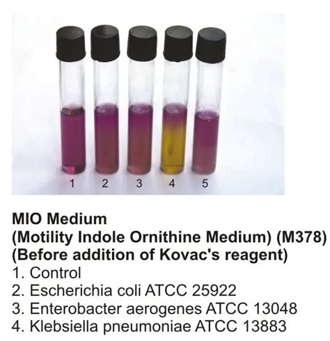 soft agar deep tests for what type of media|Motility Test Medium Protocol .